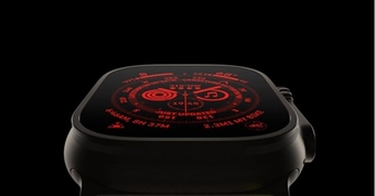 "Apple Watch: Dự Đoán Tính Năng 