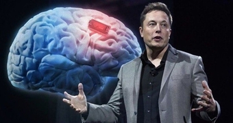 Elon Musk tự cấy chip não vào cơ thể