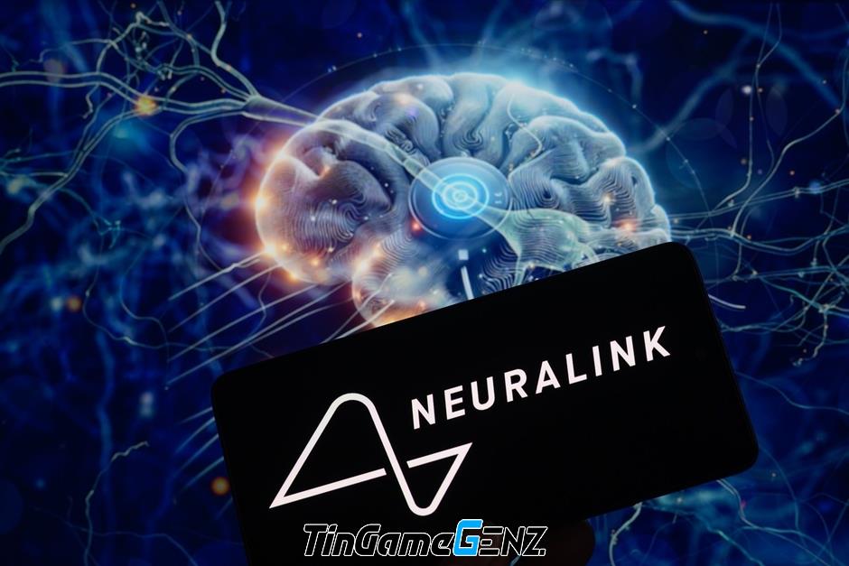 Người Thứ Hai Cấy Ghép Neuralink: Vừa Làm Lành, Đã Chinh Phục Counter-Strike Chỉ Bằng Ý Nghĩ!